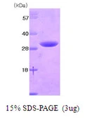 Human 14-3-3 eta protein, His tag. GTX67945-pro