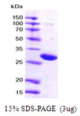 Human 14-3-3 zeta protein, His tag. GTX67947-pro