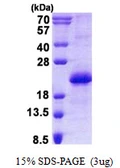 Human CNBP protein, His tag. GTX67948-pro