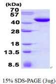 Human MAPKAP Kinase 3 protein, His tag. GTX67952-pro