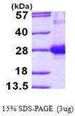 Human RAB7A protein, His tag. GTX67953-pro