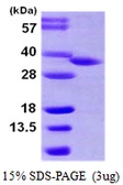 Human HSD17B8 protein, His tag. GTX67955-pro