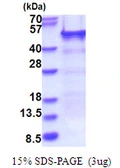 Human NELF-E protein, His tag. GTX67957-pro