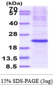 Human MAFK protein, His tag. GTX67958-pro