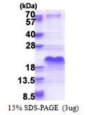 Human DSS1 protein, His tag. GTX67959-pro