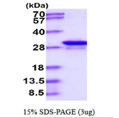 Human GAS41 protein, His tag. GTX67961-pro