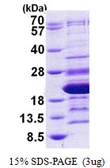 Human HMGA2 protein, His tag. GTX67962-pro