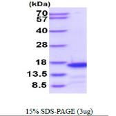 Human CDK2AP1 protein, His tag. GTX67963-pro