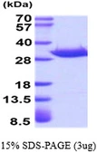 Human ANP32A protein, His tag. GTX67965-pro