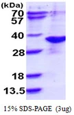 Human ARD1A protein, His tag. GTX67968-pro