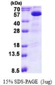 Human PIP4K2B protein, His tag. GTX67971-pro