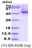 Human SPOP protein, His tag. GTX67972-pro