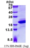 Human UXT protein, His tag. GTX67973-pro