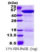 Human Nck beta protein, His tag. GTX67974-pro