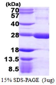 Human RGS5 protein, His tag. GTX67975-pro