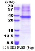 Human NIPSNAP protein, His tag. GTX67976-pro