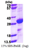 Human DENR protein, His tag. GTX67979-pro