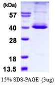 Human STK16 protein, His tag. GTX67983-pro