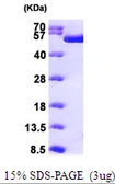 Human RUVBL1 protein, His tag. GTX67984-pro