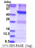 Human RTCD1 protein, His tag. GTX67987-pro