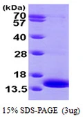 Human MP1 protein, His tag. GTX67989-pro