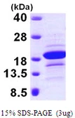 Human EDF1 protein, His tag. GTX67996-pro