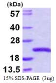 Human SNX3 protein, His tag. GTX67997-pro