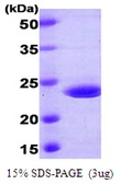 Human RAIDD protein, His tag. GTX68001-pro