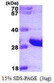 Human FADD protein, His tag. GTX68003-pro