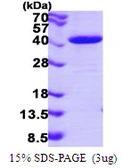 Human NAPG protein, His tag. GTX68005-pro