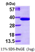 Human alpha SNAP protein, His tag. GTX68006-pro