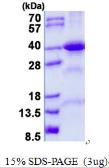 Human FBP2 protein, His tag. GTX68007-pro