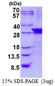 Human LIN7A protein, His tag. GTX68008-pro