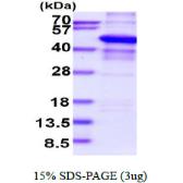 Human SQSTM1 / P62 protein, His tag. GTX68012-pro