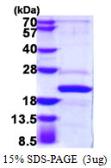 Human AP1S2 protein, His tag. GTX68015-pro