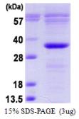 Human BCL10 protein, His tag. GTX68016-pro