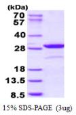 Human NOL3 protein, His tag. GTX68019-pro