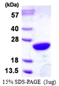 Human UBE2M protein, His tag. GTX68022-pro