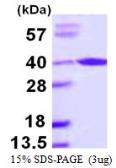 Human ARA9 protein, His tag. GTX68023-pro