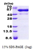 Human PSTPIP1 protein, His tag. GTX68024-pro
