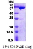 Human USP14 protein, His tag. GTX68026-pro