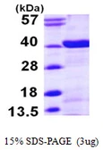 Human N-myc interactor protein, His tag. GTX68028-pro