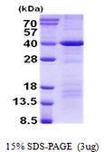 Human DEDD protein, His tag. GTX68033-pro