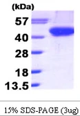 Human Aurora B protein, His tag. GTX68034-pro