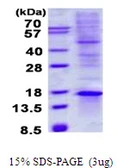 Human TIAF1 protein, His tag. GTX68035-pro