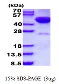 Human DRAK2 protein, His tag. GTX68038-pro