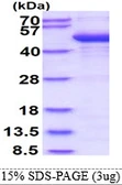 Human Cytohesin 2 protein, His tag. GTX68040-pro