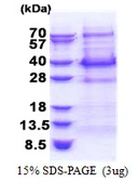 Human BCL7C protein, His tag. GTX68042-pro