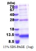 Human C5orf13 protein, His tag. GTX68044-pro