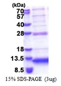 Human C5orf13 protein, His tag. GTX68044-pro